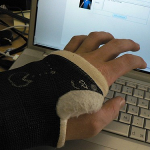 arm with cast trying to type on computer